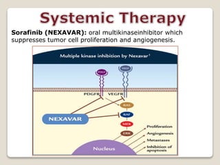 Sorafinib (NEXAVAR): oral multikinaseinhibitor which
suppresses tumor cell proliferation and angiogenesis.
 