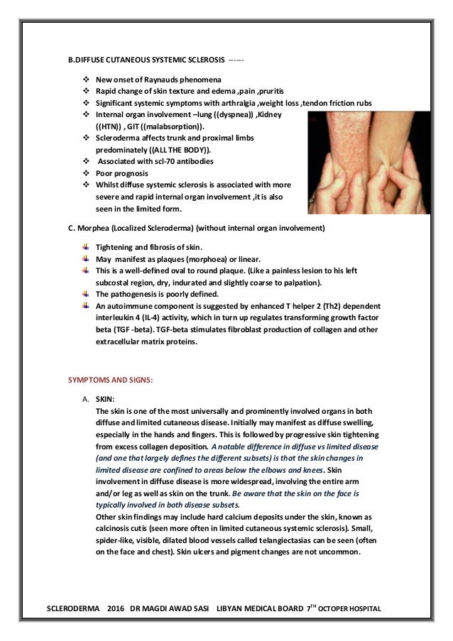 SCLERODERMA DR MAGDI AWAD SASI 2016 LMB