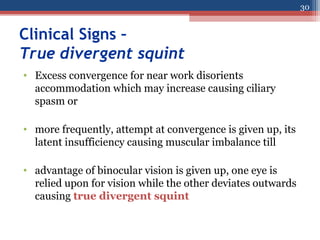 Clinical Signs –
True divergent squint
• Excess convergence for near work disorients
accommodation which may increase causing ciliary
spasm or
• more frequently, attempt at convergence is given up, its
latent insufficiency causing muscular imbalance till
• advantage of binocular vision is given up, one eye is
relied upon for vision while the other deviates outwards
causing true divergent squint
30
 