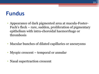 Fundus
• Appearance of dark pigmented area at macula-Foster-
Fuch’s fleck – rare, sudden, proliferation of pigmentary
epithelium with intra-choroidal haemorrhage or
thrombosis
• Macular bunches of dilated capillaries or aneurysms
• Myopic crescent – temporal or annular
• Nasal supertraction crescent
33
 