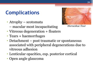 Complications
• Atrophy – scotomata
– macular most incapacitating
• Vitreous degeneration + floaters
• Tears + haemorrhages
• Detachment – post traumatic or spontaneous
associated with peripheral degenerations due to
vitreous adhesion
• Lenticular opacities, esp. posterior cortical
• Open angle glaucoma
Horseshoe Tear
39
 