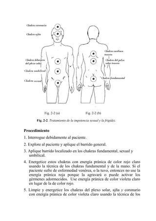 Fig. 2-2 (a) Fig. 2-2 (b) 
Fig. 2-2. Tratamiento de la impotencia sexual y la frigidez. 
Procedimiento 
1. Interrogue debidamente al paciente. 
2. Explore al paciente y aplique el barrido general. 
3. Aplique barrido localizado en los chakras fundamental, sexual y umbilical. 
4. Energetice estos chakras con energía pránica de color rojo claro usando la técnica de los chakras fundamental y de la mano. Si el paciente sufre de enfermedad venérea, o la tuvo, entonces no use la energía pránica roja porque la agravará o puede activar los gérmenes adormecidos. Use energía pránica de color violeta claro en lugar de la de color rojo. 
5. Limpie y energetice los chakras del plexo solar, ajña y coronario con energía pránica de color violeta claro usando la técnica de los  