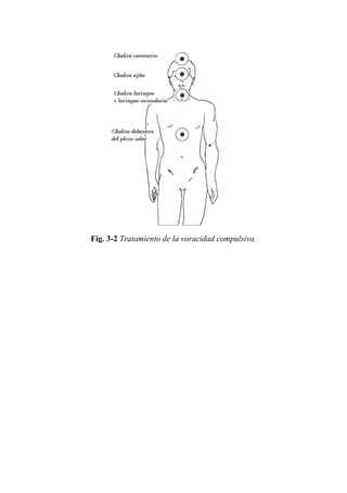 Fig. 3-2 Tratamiento de la voracidad compulsiva. 
 