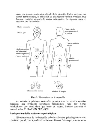 veces por semana, o más, dependiendo de la situación. En los pacientes que sufran depresión leve, la aplicación de esta técnica curativa producirá muy buenos resultados después de varios tratamientos. En algunos casos, el efecto es casi instantáneo. 
Fig. 5-1 Tratamiento de la depresión 
Los sanadores pránicos avanzados pueden usar la técnica curativa magistral que producirá resultados rapidísimos. Pero hay ciertas restricciones que usted tiene que tener en cuenta. Sírvase consultar el manual sobre CURACIÓN PRÁNICA. 
La depresión debida a factores psicológicos 
El tratamiento de la depresión debida a factores psicológicos es casi el mismo que el correspondiente a factores físicos. Salvo que, en este caso,  