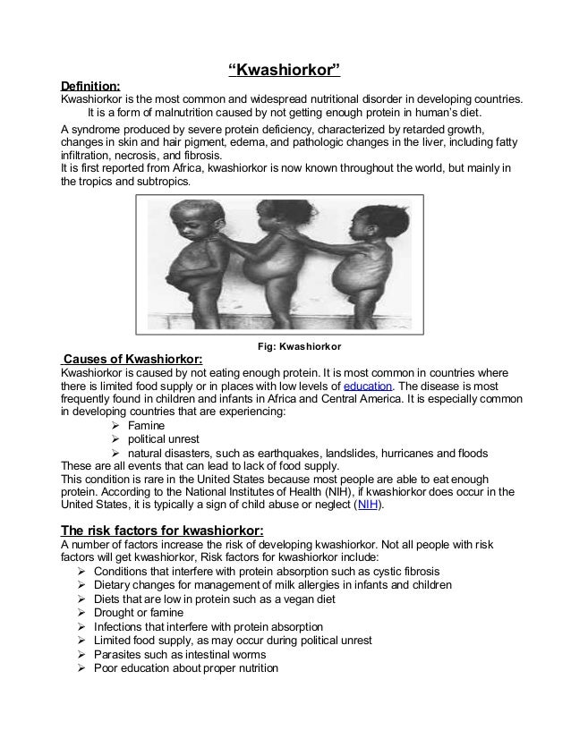 Assignment Kwashiorkor _Final