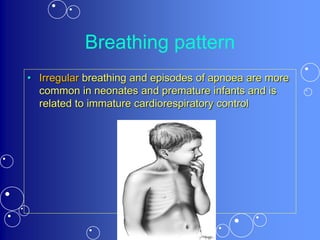 Breathing pattern
• Irregular breathing and episodes of apnoea are more
common in neonates and premature infants and is
related to immature cardiorespiratory control
 