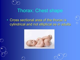 Thorax: Chest shape
• Cross sectional area of the thorax is
cylindrical and not elliptical as in adults
 