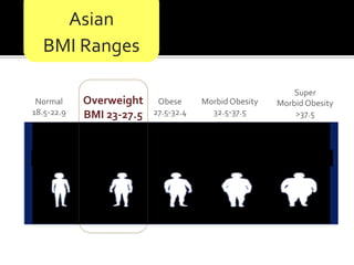 Asian
BMI Ranges
Overweight
BMI 23-27.5
Normal
18.5-22.9
Super
Morbid Obesity
>37.5
Morbid Obesity
32.5-37.5
Obese
27.5-32.4
 
