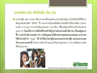 แพทย์สภายัน ตัดไข่เด็ก ผิด (1)
 บรรดาตุ๊ด แต๋ว กะเทย ที่อยากจะเปลี่ยนเพศจากชายเป็นหญิง พากันหันไปใช้วิธีการ
ตัดลูกอัณฑะหรือ “ตัดไข่” ทิ้ง จนกลายเป็นแฟชั่นฮิต โดยเสียค่าใช้จ่ายเพียง 4,000-
5,000 บาท ถูกกว่าการผ่าตัดแปลงเพศ “เฉาะจิ๋ม” ที่ต้องเสียค่าใช้จ่ายเป็นเงินหลาย
แสนบาท โดยเชื่อว่าการตัดไข่ทิ้งจะทาให้รูปร่างผิวพรรณดี มีความ เป็นหญิงมาก
ขึ้น กอปรกับมีกระแสข่าวว่า จะมีกฎหมายให้บรรดาบุคคลประเภทสอง สามารถ
ใช้คานาหน้าว่า “น.ส.” ได้ ทาให้บรรดาผู้ปกครองของบรรดาตุ๊ด แต๋วและกะเทย
วัยกระเตาะเหล่านี้ เกิดความวิตกกังวลและเป็นห่วงลูกหลาน ว่าอาจมีอันตรายต่อ
ชีวิตในอนาคต
http://tnews.teenee.com/crime/21912.html
 