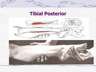 Tibial Posterior
Paciente: DD com o membro rotação lateral.
Fixação: O examinador sustenta a perna acima da
art. do tornozelo.
Prova: Inversão do pé com flexão plantar.
Pressão: Contra o lado medial e superfície plantar do
pé, na direção da dorsiflexão da art. do tornozelo e
eversão do pé.
Fraqueza: Diminui a capacidade de inverter o pé e
fletir plantarmente. Resulta em pronação do pé e
sustentação diminuída do arco longitudinal.
Contratura: Posição eqüino vara quando sem
sustentação de peso e uma posição supinada do
calcanhar com antepé varo quando com sustentação
de peso.
 
