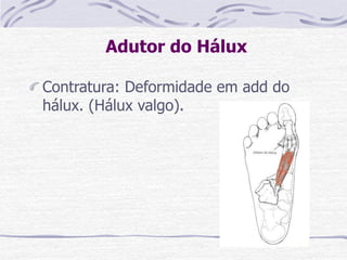 Adutor do Hálux
Contratura: Deformidade em add do
hálux. (Hálux valgo).
 