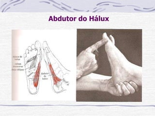Abdutor do Hálux
Paciente: DD ou sentado
Fixação: O examinador segura o calcanhar
firmemente
Prova: Se possível, abdução do hálux a partir da linha
axial do pé. Isso é difícil para o indivíduo médio, e a
ação pode ser demonstrada fazendo-se o paciente
puxar o antepé em add contra pressão pelo
examinador.
Fraqueza: Possibilita o antepé valgo, hálux valgo e
deslocamento medial navicular.
Contratura: Puxa o pé para antepé varo com hálux
abd.
 