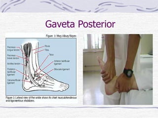 Gaveta Posterior
• Diagnosticar Ruptura do
lig. Talofibular posterior
•
• Aumento da mobilidade
posterior
• Traumas (entorses)
graves
 