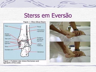 Sterss em Eversão
• Diagnosticar Ruptura
dos ligg. Deltóideos
• Aumento da mobilidade
para eversão
• Entorse em eversão
 