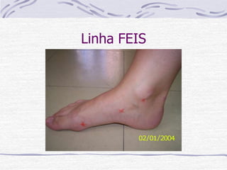 Linha FEIS
Plano
Cavo
 