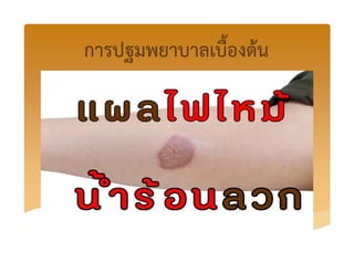 การปฐมพยาบาลเบื้องตKน
 