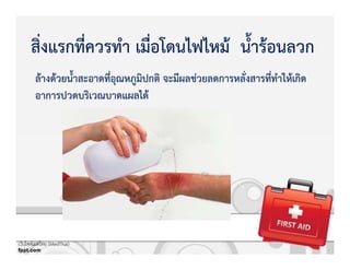 ลKางดKวยน้ําสะอาดที่อุณหภูมิปกติ จะมีผลชZวยลดการหลั่งสารที่ทําใหKเกิด
อาการปวดบริเวณบาดแผลไดK
สิ่งแรกที่ควรทํา เมื่อโดนไฟไหมK น้ํารKอนลวก
เว็บไซตเมดไทย (MedThai)
 