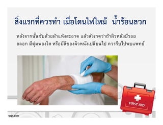 หลังจากนันซับด้วยผ้าแห้งสะอาด แล้วสังเกตว่าถ้าผิวหนังมีรอย
ถลอก มีตุ่มพองใส หรือมีสีของผิวหนังเปลียนไป ควรรีบไปพบแพทย์
สิ่งแรกที่ควรทํา เมื่อโดนไฟไหมK น้ํารKอนลวก
 