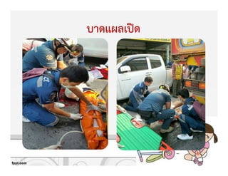 บาดแผลเปtด
 