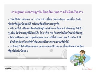 การปฐมพยาบาลกระดูกหัก ขKอเคลื่อน หลักการเขKาเฝvอกชั่วคราว
- วัสดุที่ใชKดามตKองยาวกวZาอวัยวะสZวนที่หัก โดยจะตKองยาวพอที่จะบังคับ
ขKอตZอที่อยูZเหนือและใตK บริเวณที่สงสัยวZากระดูกหัก
- บริเวณที่เขKาเฝvอกจะตKองจัดใหKอยูZในทZาที่สบายที่สุด อยZาจัดกระดูกใหKเขKา
รูปเดิม ไมZวZากระดูกที่หักจะโคKง โกZง หรือ คด ก็ควรเขKาเฝvอกในทZาที่เปpนอยูZ
- ไมZวางเฝvอกลงบนกระดูกหักโดยตรง ควรมีสิ่งอื่นรอง เชZน ผKา หรือ สําลี
- มัดเฝvอกกับอวัยวะที่หักใหKแนZนพอที่จะประคองสZวนที่หักไดK
- ระวังอยZาใหKปมเชือกกดแผล เพราะอาจจะมีการบวม ซึ่งจะตKองคลายเชือก
ที่ผูกใหKแนZนนKอยลง
 