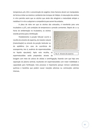 temperatura, pH, CO2 e concentração de oxigénio. Estes factores devem ser manipulados
de forma a imitar ao máximo o ambiente das trompas de Falópio. A maturação dos oócitos
in vitro permite assim que os oócitos que ainda não atingiram a maturidade atinjam a
metáfase II in vitro e adquiram a competência para serem fecundados.
A placa de vidro em que os oócitos são colocados, é transferida para uma
incubadora a 37°C, sob condições de temperatura e pressão constantes. Depois de 2 a 4
horas de ambientação na incubadora, os oócitos
estarão prontos para a fertilização
Paralelamente à punção folicular ocorre a
recolha da amostra de esperma, de maneira natural
(masturbação) ou através da punção testicular ou
do

epidídimo

(no

caso

da

ocorrência

de

azoospermia, isto é, ausência de espermatozóides
no

líquido

ejaculado).

espermatozóides

serão

Após

esta

recolha,

os

preparados

através

da

Fig. 8 - Amostra de esperma
recolhida

lavagem com meio de cultura de células e centrifugação, fazendo com que haja uma
separação do plasma seminal, resultando em espermatozóides com maior mobilidade e
capacidade para fertilização. Este processo é importante porque remove substâncias
químicas e bactérias que podem causar reacções adversas ou contracções uterinas
intensas.

10

 