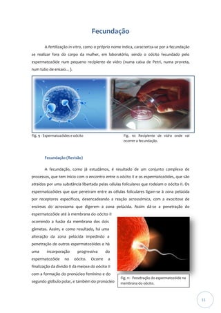 Fecundação
A fertilização in vitro, como o próprio nome indica, caracteriza-se por a fecundação
se realizar fora do corpo da mulher, em laboratório, sendo o oócito fecundado pelo
espermatozóide num pequeno recipiente de vidro (numa caixa de Petri, numa proveta,
num tubo de ensaio…).

Fig. 9 - Espermatozóides e oócito

Fig. 10: Recipiente de vidro onde vai
ocorrer a fecundação.

Fecundação (Revisão)
A fecundação, como já estudámos, é resultado de um conjunto complexo de
processos, que tem início com o encontro entre o oócito II e os espermatozóides, que são
atraídos por uma substância libertada pelas células foliculares que rodeiam o oócito II. Os
espermatozóides que que penetram entre as células foliculares ligam-se à zona pelúcida
por receptores específicos, desencadeando a reação acrossómica, com a exocitose de
enzimas do acrossoma que digerem a zona pelúcida. Assim dá-se a penetração do
espermatozóide até à membrana do oócito II
ocorrendo a fusão da membrana dos dois
gâmetas. Assim, e como resultado, há uma
alteração da zona pelúcida impedindo a
penetração de outros espermatozóides e há
uma

incorporação

espermatozóide

no

progressiva
oócito.

Ocorre

do
a

finalização da divisão II da meiose do oócito II
com a formação do pronúcleo feminino e do
segundo glóbulo polar, e também do pronúcleo

Fig. 11 - Penetração do espermatozóide na
membrana do oócito.

11

 