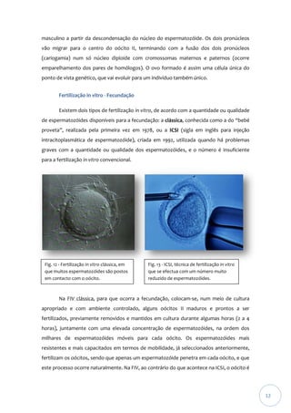 masculino a partir da descondensação do núcleo do espermatozóide. Os dois pronúcleos
vão migrar para o centro do oócito II, terminando com a fusão dos dois pronúcleos
(cariogamia) num só núcleo diploide com cromossomas maternos e paternos (ocorre
emparelhamento dos pares de homólogos). O ovo formado é assim uma célula única do
ponto de vista genético, que vai evoluir para um indivíduo também único.
Fertilização in vitro - Fecundação
Existem dois tipos de fertilização in vitro, de acordo com a quantidade ou qualidade
de espermatozóides disponíveis para a fecundação: a clássica, conhecida como a do “bebé
proveta”, realizada pela primeira vez em 1978, ou a ICSI (sigla em inglês para injeção
intracitoplasmática de espermatozóide), criada em 1992, utilizada quando há problemas
graves com a quantidade ou qualidade dos espermatozóides, e o número é insuficiente
para a fertilização in vitro convencional.

Fig. 12 - Fertilização in vitro clássica, em
que muitos espermatozóides são postos
em contacto com o oócito.

Fig. 13 - ICSI, técnica de fertilização in vitro
que se efectua com um número muito
reduzido de espermatozóides.

Na FIV clássica, para que ocorra a fecundação, colocam-se, num meio de cultura
apropriado e com ambiente controlado, alguns oócitos II maduros e prontos a ser
fertilizados, previamente removidos e mantidos em cultura durante algumas horas (2 a 4
horas), juntamente com uma elevada concentração de espermatozóides, na ordem dos
milhares de espermatozóides móveis para cada oócito. Os espermatozóides mais
resistentes e mais capacitados em termos de mobilidade, já seleccionados anteriormente,
fertilizam os oócitos, sendo que apenas um espermatozóide penetra em cada oócito, e que
este processo ocorre naturalmente. Na FIV, ao contrário do que acontece na ICSI, o oócito é

12

 