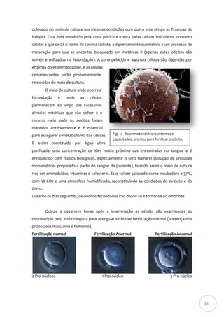 colocado no meio de cultura nas mesmas condições com que o este atinge as Trompas de
Falópio. Este está envolvido pela zona pelúcida e esta pelas células foliculares, conjunto
celular a que se dá o nome de corona radiata, e é previamente submetido a um processo de
maturação para que se encontre bloqueado em metáfase II (apenas estes oócitos são
viáveis e utilizados na fecundação). A zona pelúcida e algumas células são digeridas por
enzimas do espermatozóide, e as células
remanescentes serão posteriormente
removidas do meio de cultura.
O meio de cultura onde ocorre a
fecundação

e

onde

as

células

permanecem ao longo das sucessivas
divisões mitóticas que vão sofrer é o
mesmo meio onde os oócitos foram
mantidos anteriormente e é essencial
para assegurar o metabolismo das células.

Fig. 14 - Espermatozóides resistentes e
capacitados, prontos para fertilizar o oócito.

É assim constituído por água ultrapurificada, uma concentração de iões muito próxima das encontradas no sangue e é
enriquecido com fluidos biológicos, especialmente o soro humano (solução de unidades
monoméricas preparado a partir do sangue da paciente), ficando assim o meio de cultura
rico em aminoácidos, vitaminas e colesterol. Este vai ser colocado numa incubadora a 37ºC,
com 5% CO2 e uma atmosfera humidificada, reconstituindo as condições do oviduto e do
útero.
Durante os dias seguintes, os oócitos fecundados irão dividir-se e tornar-se-ão embriões.

Quinze a dezanove horas após a inseminação as células são examinadas ao
microscópio pelo embriologista para averiguar se houve fertilização normal (presença dos
pronúcleos masculino e feminino).
Fertilização normal

2 Pro-núcleos

Fertilização Anormal

1 Pro-núcleo

Fertilização Anormal

3 Pro-núcleo

13

 