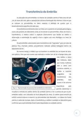 Transferência do Embrião
A colocação dos pré-embriões no interior da cavidade uterina é feita cerca de 4872h, às vezes até 120h, após a captação dos oócitos e fertilização dos mesmos. O dia em que
se colocam os pré-embriões no útero materno é definido de acordo com o
desenvolvimento específico de cada caso.
A transferência embrionária deve ser feita com a paciente em posição ginecológica,
numa sala próxima do laboratório onde se encontram os pré-embriões. Antes de iniciar a
transferência, o médico coloca o espéculo (instrumento que facilita ao médico a
observação e examinação da vagina) e lava a vagina com soro fisiológico ou meio de
cultura.
Os pré-embriões selecionados para transferência são “aspirados” para um tubo de
plástico fino, chamado catéter, procedimento realizado pelo(a) biólogo(a) dentro do
laboratório de FIV.
Ao mesmo tempo, o médico que vai transferir os embriões faz um exame de ultrasom pélvico. Para que este exame seja realizado a mulher tem de ter a bexiga cheia, pois
isto retifica o útero
das mulheres, dado
que muitas mulheres
têm o útero com
curvatura anterior, e
facilita

o

controlo

ecográfico

da

transferência

dos

embriões.

Este

exame é de extrema
importância
Fig. 16 - Representação do processo de transferência embrionária.

pois

permite determinar e

visualizar a entrada do catéter dentro da cavidade uterina e ter a certeza de que os préembriões estão a ser colocados no local adequado do útero. O cateter passa através do
orifício cervical externo e interno e os pré-embriões são libertados 1 cm abaixo do fundo
uterino, à saída das trompas. Após a transferência, o catéter é avaliado no laboratório para
confirmar que os pré-embriões foram todos depositados na cavidade uterina.

16

 