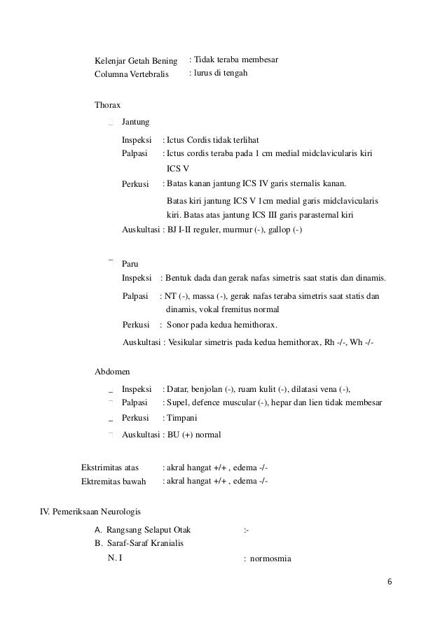 75401691 bell-s-palsy