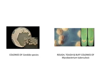 754_Respiratory_Tract_Infections.ppt