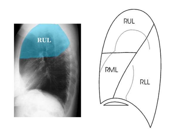 7557_interpretation-of-chest-x-ray-film.pptx