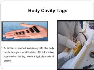 Body Cavity Tags
• A device is inserted completely into the body
cavity through a small incision. All information
is printed on the tag, which is typically made of
plastic.
 