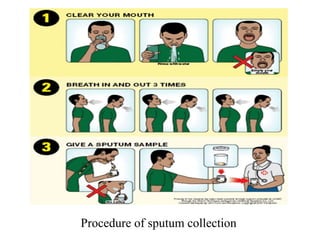 Procedure of sputum collection
 