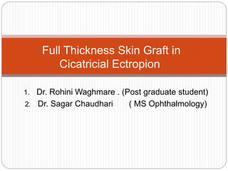 1. Dr. Rohini Waghmare . (Post graduate student)
2. Dr. Sagar Chaudhari ( MS Ophthalmology)
Full Thickness Skin Graft in
Cicatricial Ectropion
 