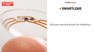 FUTURE●VISION
● SMARTLENS
Glucose sensing lenses for diabetics.
 