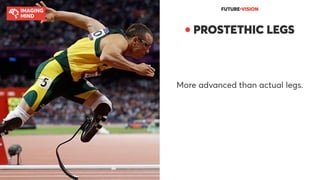 FUTURE●VISION
● PROSTETHIC LEGS
More advanced than actual legs.
 