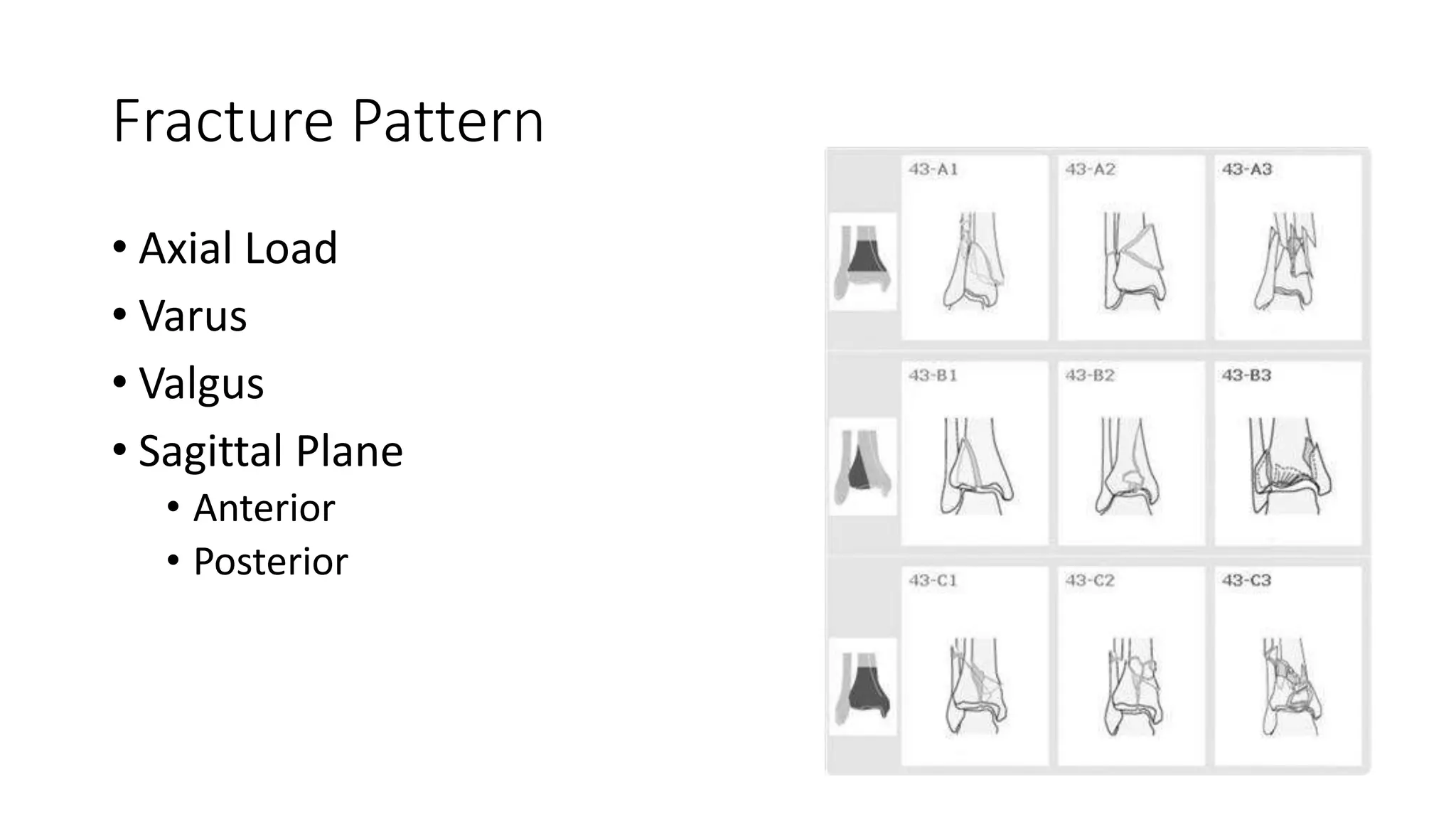 Ankle fracture: posterior malleolar fractures | PPTX