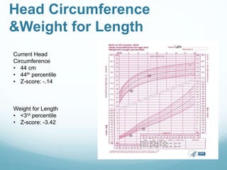 Head Circumference
&Weight for Length
Current Head
Circumference
• 44 cm
• 44th percentile
• Z-score: -.14
Weight for Length
• <3rd percentile
• Z-score: -3.42
 