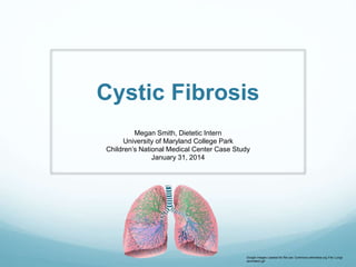 Cystic Fibrosis
Megan Smith, Dietetic Intern
University of Maryland College Park
Children’s National Medical Center Case Study
January 31, 2014
Google Images Labeled for Re-use: Commons.wikimedia.org File: Lungs
(animated).gif
 