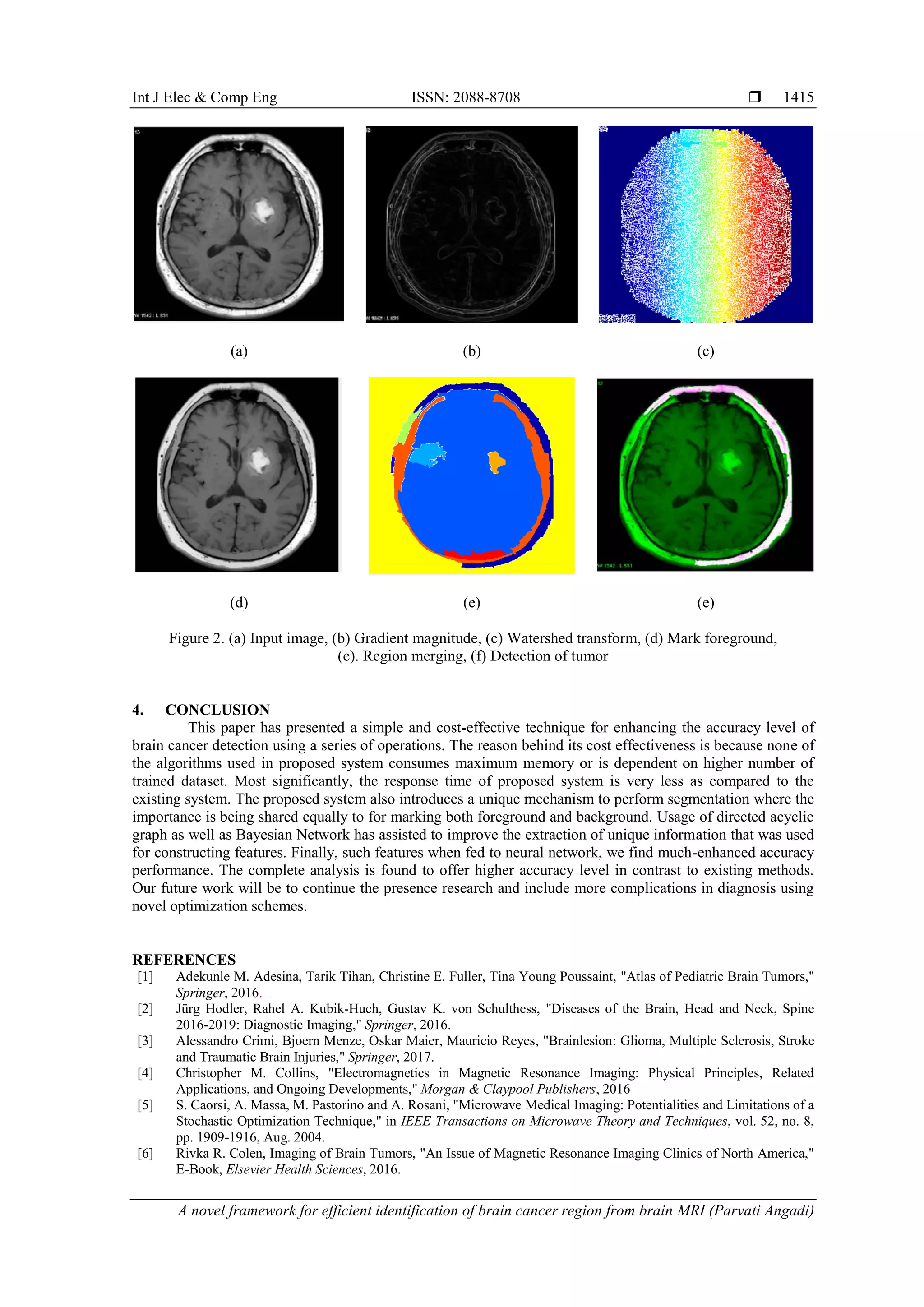 Int J Elec & Comp Eng ISSN: 2088-8708 
A novel framework for efficient identification of brain cancer region from brain MRI (Parvati Angadi)
1415
(a) (b) (c)
(d) (e) (e)
Figure 2. (a) Input image, (b) Gradient magnitude, (c) Watershed transform, (d) Mark foreground,
(e). Region merging, (f) Detection of tumor
4. CONCLUSION
This paper has presented a simple and cost-effective technique for enhancing the accuracy level of
brain cancer detection using a series of operations. The reason behind its cost effectiveness is because none of
the algorithms used in proposed system consumes maximum memory or is dependent on higher number of
trained dataset. Most significantly, the response time of proposed system is very less as compared to the
existing system. The proposed system also introduces a unique mechanism to perform segmentation where the
importance is being shared equally to for marking both foreground and background. Usage of directed acyclic
graph as well as Bayesian Network has assisted to improve the extraction of unique information that was used
for constructing features. Finally, such features when fed to neural network, we find much-enhanced accuracy
performance. The complete analysis is found to offer higher accuracy level in contrast to existing methods.
Our future work will be to continue the presence research and include more complications in diagnosis using
novel optimization schemes.
REFERENCES
[1] Adekunle M. Adesina, Tarik Tihan, Christine E. Fuller, Tina Young Poussaint, "Atlas of Pediatric Brain Tumors,"
Springer, 2016.
[2] Jürg Hodler, Rahel A. Kubik-Huch, Gustav K. von Schulthess, "Diseases of the Brain, Head and Neck, Spine
2016-2019: Diagnostic Imaging," Springer, 2016.
[3] Alessandro Crimi, Bjoern Menze, Oskar Maier, Mauricio Reyes, "Brainlesion: Glioma, Multiple Sclerosis, Stroke
and Traumatic Brain Injuries," Springer, 2017.
[4] Christopher M. Collins, "Electromagnetics in Magnetic Resonance Imaging: Physical Principles, Related
Applications, and Ongoing Developments," Morgan & Claypool Publishers, 2016
[5] S. Caorsi, A. Massa, M. Pastorino and A. Rosani, "Microwave Medical Imaging: Potentialities and Limitations of a
Stochastic Optimization Technique," in IEEE Transactions on Microwave Theory and Techniques, vol. 52, no. 8,
pp. 1909-1916, Aug. 2004.
[6] Rivka R. Colen, Imaging of Brain Tumors, "An Issue of Magnetic Resonance Imaging Clinics of North America,"
E-Book, Elsevier Health Sciences, 2016.
 