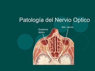 Patología del Nervio Optico
Quiasma
óptico

2do. nervio

 