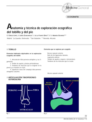 SUMARIO




                                                                                                            Medicina General

                                                                                                               ECOGRAFÍA




      A   natomía y técnica de exploración ecográfica
      del tobillo y del pie
      E. CEREZO LÓPEZ, J. LEMOS ZUNZUNEGUI*, J.    DE LA   FUENTE ORTIZ**, F. J. AMORÓS OLIVEROS***
      Madrid. *La Guardia, Pontevedra. **San Sebastián. ***Novelda, Alicante.




      s TOBILLO                                                   Elementos que se exploran por ecografía

      Elementos habituales objetivables en la exploración                   Receso capsular anterior.
      ecográfica del tobillo                                                Parte de los ligamentos laterales.
                                                                            Ligamento anterior.
            1. Articulación tibio-peroneo-astraglina y sus li-              Tendón de aquiles y espacio, retrocalcáneo.
      gamentos.                                                             Tendones de los músculos que la cruzan.
            2. Tendón de aquiles y bolsas peritendinosas.
            3. Tendones de músculos que se originan en la
      pierna y se insertan en el pie.
            4. Superficies óseas del complejo tibio-peroneo-
      astragalina calcáneo.
                                                                            Receso capsular anterior.

      s ARTICULACIÓN TIBIOPERONEO
        ASTRAGALINA




      Fig. 1.                                                     Fig. 2.

                                                                                                                                                   77
                                                                                                        MEDICINA GENERAL 2001; N.º Extraordinario: 77-92
 