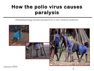 1
How the polio virus causes
paralysis
Pathophysiology of polio paralysis for a non- medical audience
January 2009
 