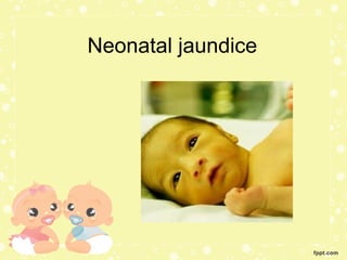 Neonatal jaundice
 