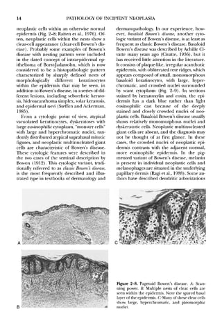 Pathology Of Incipient Neoplasia 3 Edition Henson De Ed | PDF
