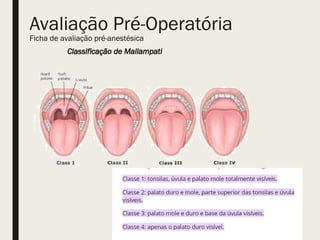 Avaliação Pré-Operatória
Ficha de avaliação pré-anestésica
Classificação de Mallampati
 