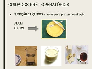 CUIDADOS PRÉ - OPERATÓRIOS
■ NUTRIÇÃO E LIQUIDOS – Jejum para prevenir aspiração
JEJUM
8 a 12h
 