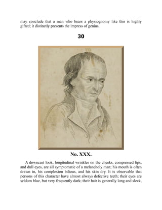 may conclude that a man who bears a physiognomy like this is highly
gifted; it distinctly presents the impress of genius.
30
No. XXX.
A downcast look, longitudinal wrinkles on the cheeks, compressed lips,
and dull eyes, are all symptomatic of a melancholy man; his mouth is often
drawn in, his complexion bilious, and his skin dry. It is observable that
persons of this character have almost always defective teeth; their eyes are
seldom blue, but very frequently dark; their hair is generally long and sleek,
 