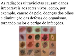As radiações ultravioletas causam danos
irreparáveis aos seres vivos, como, por
exemplo, cancro da pele, doenças dos olhos
e diminuição das defesas do organismo,
tornando maior o perigo de infecções.
 